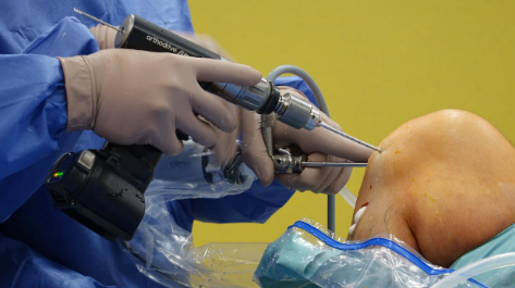 Knee pain treatment