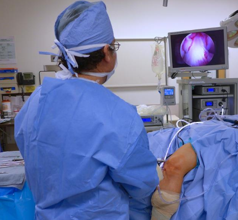 arthroscopic knee surgery
