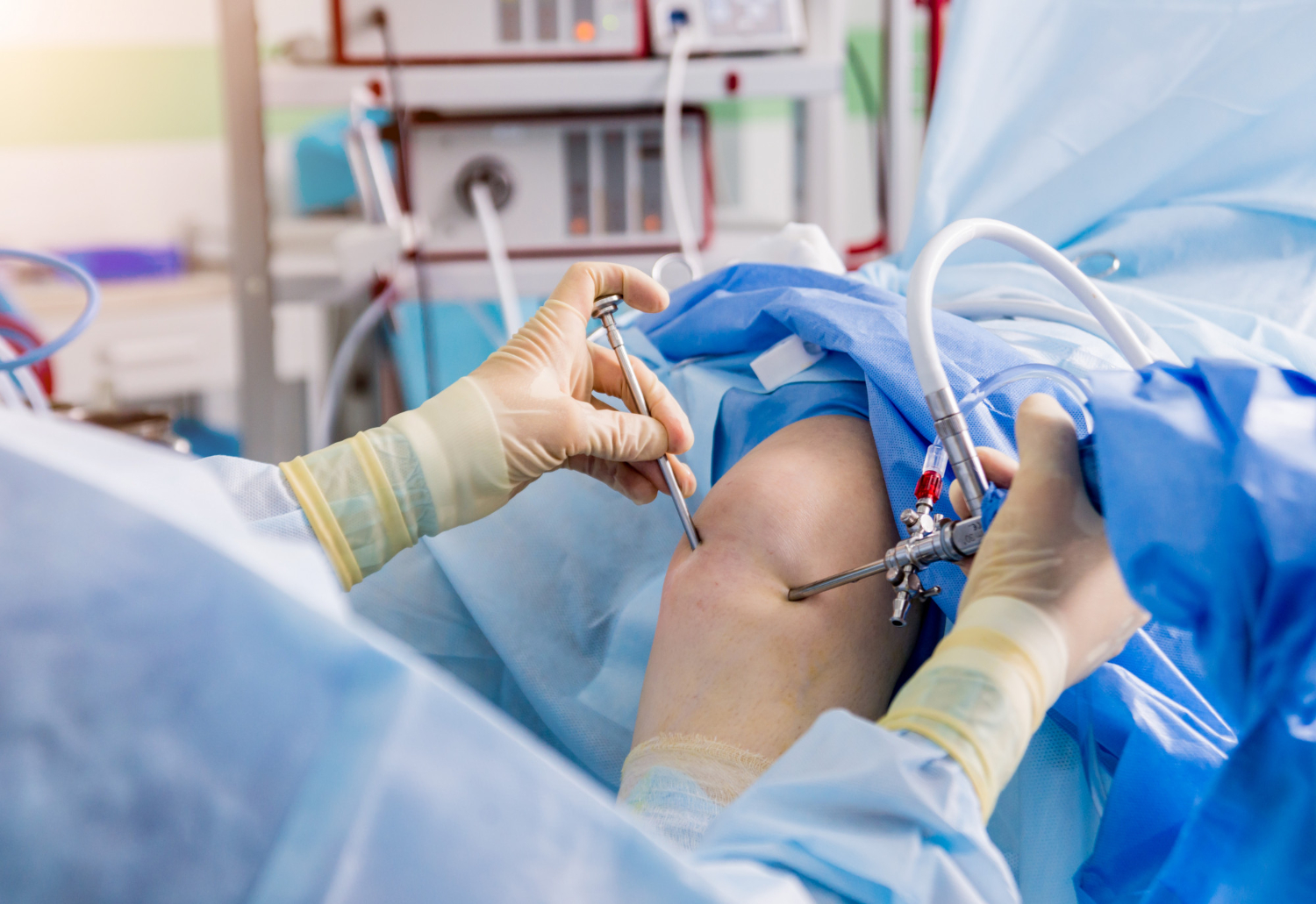 ACL Reconstruction Surgery