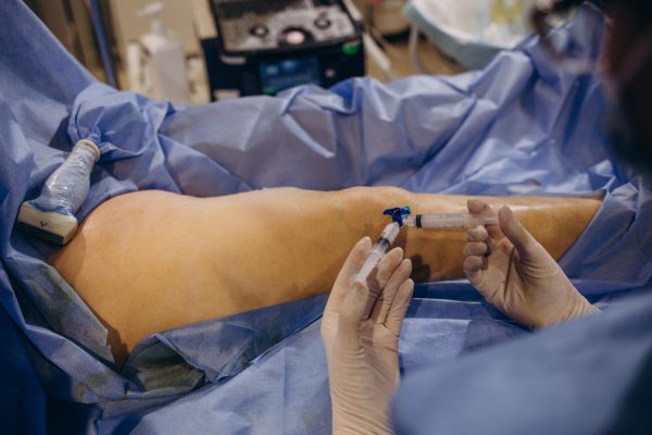 mcl reconstruction procedure