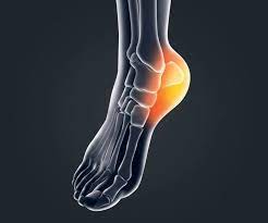 Foot Ankle Heel Pain Treatment in Hyderabad